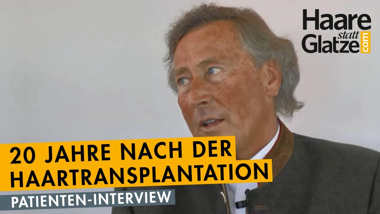 20 Jahre nach der Haartransplantation - so sieht Patient heute aus