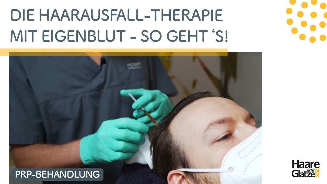 Haartherapie mit Eigenblut - so erfolgt die Behandlung gegen Haarausfall | Moser Medical